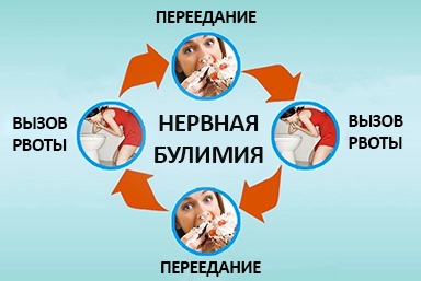 Лечение булимии в Новофёдоровке
